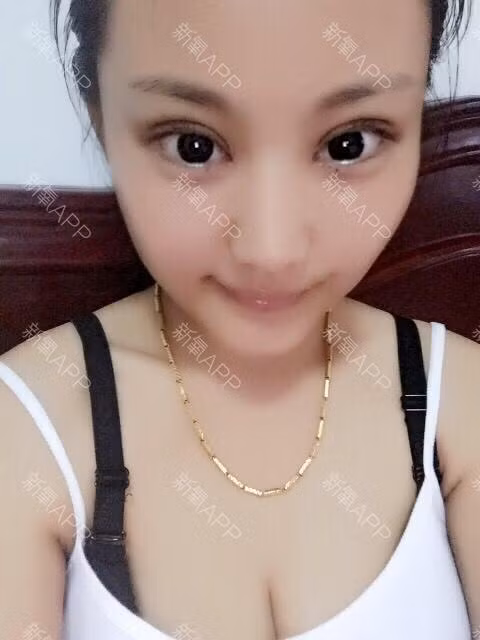 30 ngay bien hoa cua co nang phau thuat tham my-Hinh-3