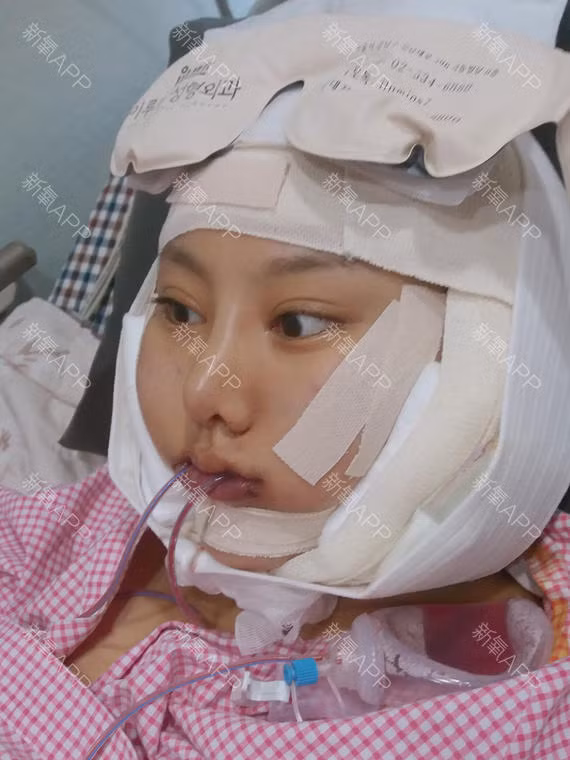 30 ngay bien hoa cua co nang phau thuat tham my-Hinh-9