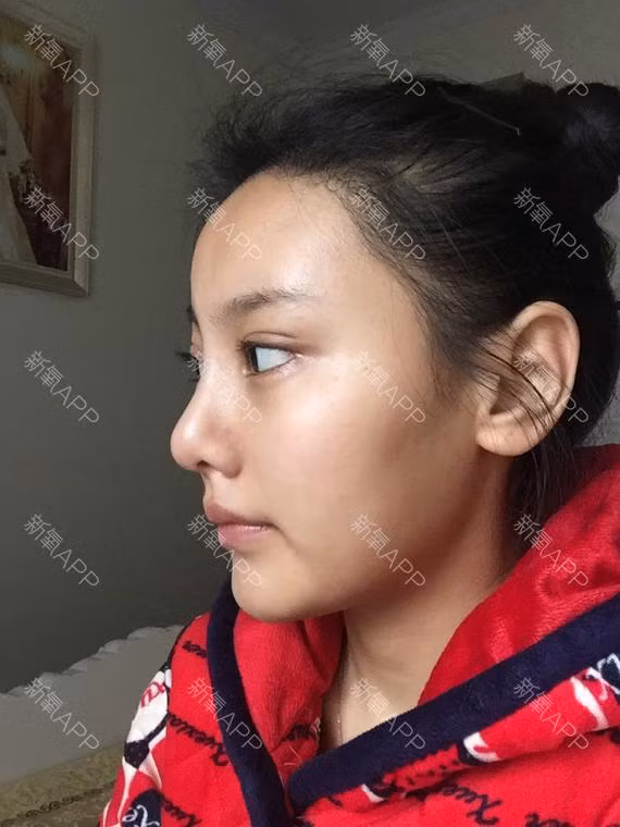 30 ngay bien hoa cua co nang phau thuat tham my-Hinh-6