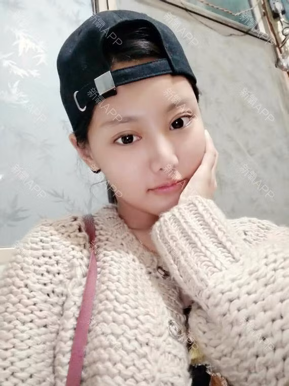 30 ngay bien hoa cua co nang phau thuat tham my-Hinh-12