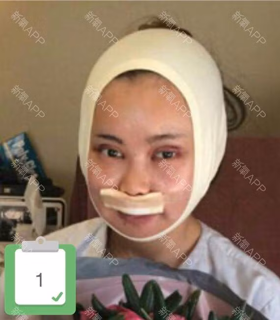 co nang vit hoa thien nga nho phau thuat-Hinh-4