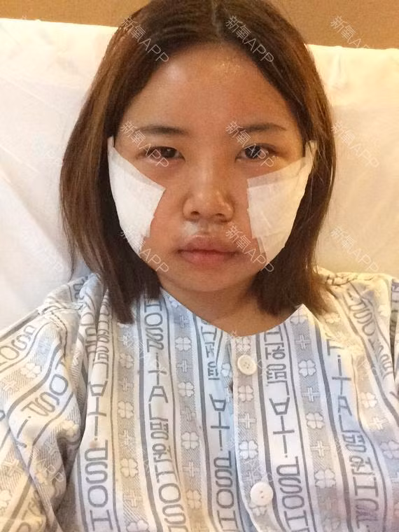 Thế nhưng cô lại không vừa ý với khuôn mặt ngang bè của của mình. Với sự tư vấn của các bác sĩ, cô quyết định tiến hành phẫu thuật thẫm mỹ, cụ thể là sửa lại xương gò má và góc hàm dưới của mình.