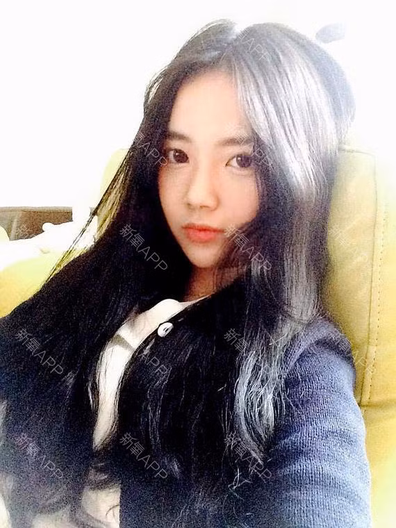 Sau 6 tháng phẫu thuật, giờ đây cô nàng đã có một khuôn mặt chuẩn không cần chỉnh với tạo hình V-line tỉ lệ vàng.