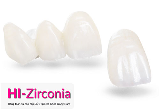 Trong rang gia co dinh voi gia uu dai tai Nha Khoa Dong Nam-Hinh-2