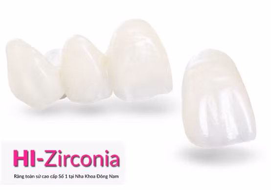 Trong rang gia co dinh voi gia uu dai tai Nha Khoa Dong Nam-Hinh-2