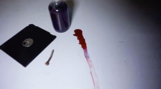 Am anh trong benh vien Hoang gia bo hoang o Anh-Hinh-8