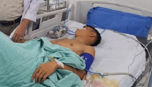  4. Hỗn chiến trong quán nhậu, thanh niên bị bắn 13 phát đạn hoa: Ngày 5/11, Công an tỉnh Quảng Nam đang điều tra vụ xô xát xảy ra giữa 2 nhóm thanh niên khiến một nam thanh niên 18 tuổi bị bắn đạn hoa cải suýt chết. Trước đó, khoảng 0h ngày 4/11, hai nhóm nhậu tại quán Rồng Vàng (thị trấn Nam Phước) đã xảy ra mâu thuẫn. Sau khi lời qua tiếng lại, hai nhóm lau vào hỗn chiến. Trong lúc xảy ra xô xát, Nguyễn Thế Tuấn (18 tuổi; ngụ thị trấn Nam Phước, huyện Duy Xuyên) bị bắn nhiều phát vào người.