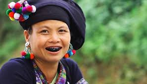  4. Răng đen: Snezhana cảm thấy khá hứng thú với tục nhuộm răng đen của phụ nữ Việt thời xưa. Cô chia sẻ ngày nay du khách vẫn có thể gặp những phụ nữ lớn tuổi người Việt vẫn còn hàm răng đen.
