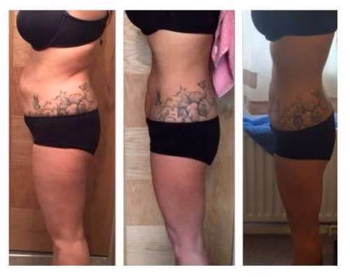 Danh bay 5kg mo thua trong 3 ngay chi nho dua-Hinh-2