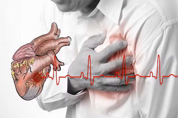 Bệnh tim mạch: Các tác dụng phụ về tim mạch bao gồm đau thắt ngực do salicylat gây ra, giảm bạch cầu và hạ huyết áp,...