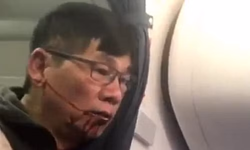 United Airlines boi thuong "khung" cho bac si Dao