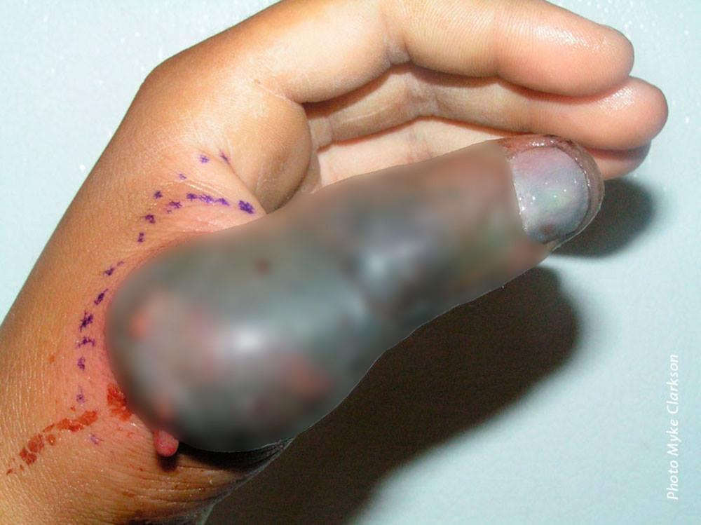 Loài rắn lạ này lẩn khuất giữa những khoảng rừng xanh giữa New Guinea và Liberia (Tây Phi), dù sở hữu nọc độc không quá mạnh, nhưng xét trên một vài góc độ thì chúng còn kinh khủng hơn. Bởi lẽ, loài rắn này có thể mổ mà không cần mở miệng.