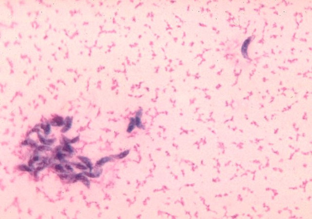 Ký sinh trùng Toxoplasma gondii thường được gọi là trùng cong, chúng là một đơn bào thuộc lớp trùng bào tử (Sporozoa). Sinh vật ký sinh ở tế bào nội mô và các tế bào hệ thống võng của hạch, não, phổi, mắt và các phủ tạng khác. Chúng ký sinh ở đâu thường gây ra tổn thương ở đó.