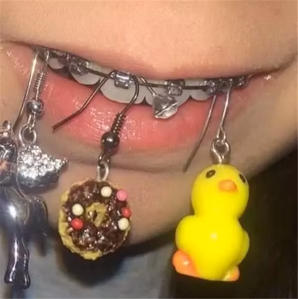 Niềng răng vốn đã rất đau đớn, thế nên rất nhiều người không hiểu nổi hành động của cô gái trẻ này.