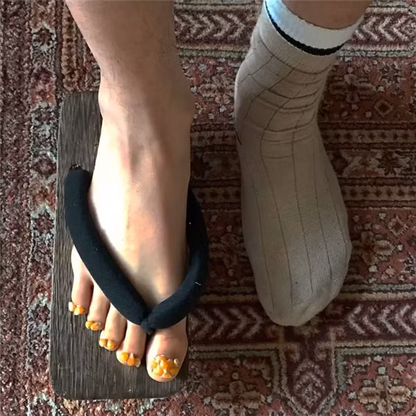 Hình ảnh độc lạ này được bầu chọn là một trong những hình ảnh gây khó chịu nhất trên Internet. Lý do là bởi móng chân của cô gái này trông giống như đang sùi ra những vật chất màu vàng, có phần ghê rợn.