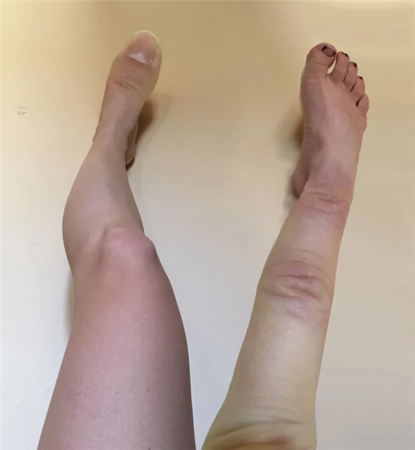 Tiếp tục là một sự thay đổi bộ phận cơ thể ra đời từ phần mềm chỉnh sửa photoshop.