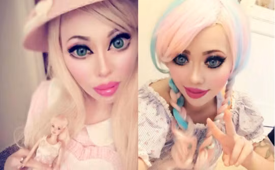 Cô Ophelia Vanity, 30 tuổi, sống tại Los Angeles, Mỹ mới đây tiếp tục chi trả tới 4000 đô la Mỹ để phẫu thuật cắt mí. Theo Ophelia, việc cắt mí sẽ giúp cô có gương mặt giống như búp bê Barbie.