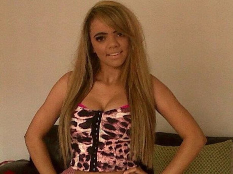 Kayla trước khi phẫu thuật