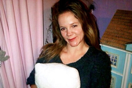 Georgina trước khi phẫu thuật.