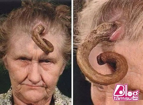 "Người mọc sừng" là những người bị mọc sừng trên đỉnh đầu, mọc sừng sau gáy, mọc sừng ở tai và thậm chí là mọc nhiều sừng. Người phụ nữ bị coi như "dị nhân" vì mọc một chiếc sừng trên đầu.