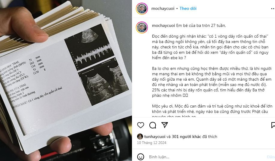 Trước đó, Tun Phạm từng có khoảng thời gian vướng tin đồn yêu đương với Emma Nhất Khanh. Tuy nhiên, với phong cách làm nội dung hài hước từ xưa đến nay, nhiều người cho rằng cặp đôi chỉ đang "làm content" mà thôi. Thời gian gần đây Tun Phạm cũng không còn làm video đôi nhiều cùng với Emma nữa. Emma cũng thường xuyên xuất hiện tại nhiều sự kiện với trang phục khoe vòng 2 thon gọn nên không thể nào có chuyện cô nàng mang thai mà không bị phát hiện.