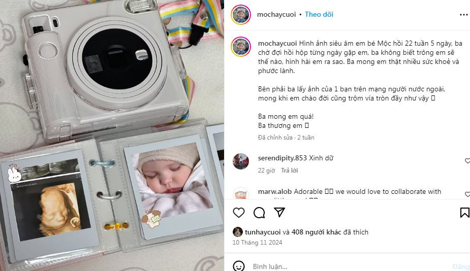 Nhiều người đã bày tỏ sự bất ngờ trước thông tin Tun Phạm có em bé, bên cạnh đó, nhiều người cũng thắc mắc mẹ của em bé là ai, bởi Tun Phạm chưa từng chính thức công khai một mối quan hệ yêu đương chính thức nào.