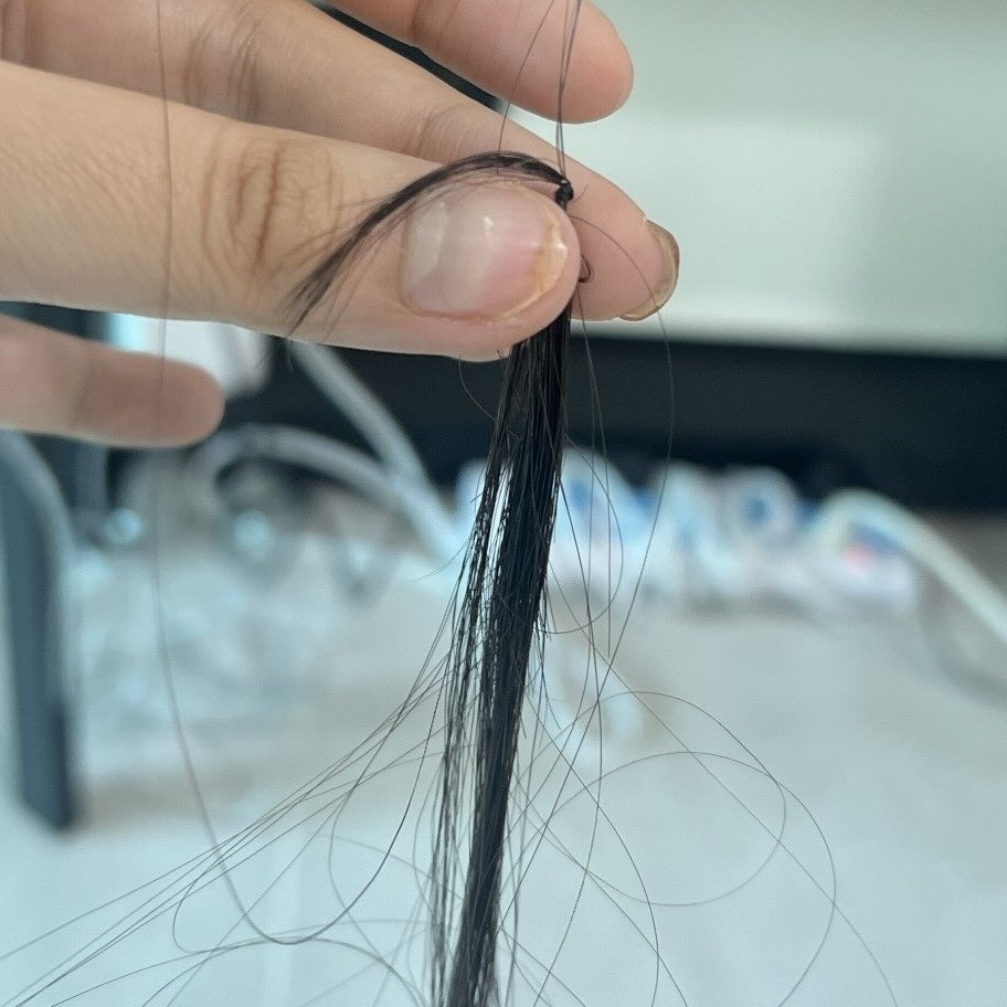 Cô chia sẻ: "Da t bị rạn do tăng cân đột ngột mọi người ạ. Trị rạn da chích kim đau thấu trời xanh. Tóc t thì bị rụng, sợ hãi quá ai gặp cũng xót. Nên phải cắt ngắn đi cho nó mọc lại".