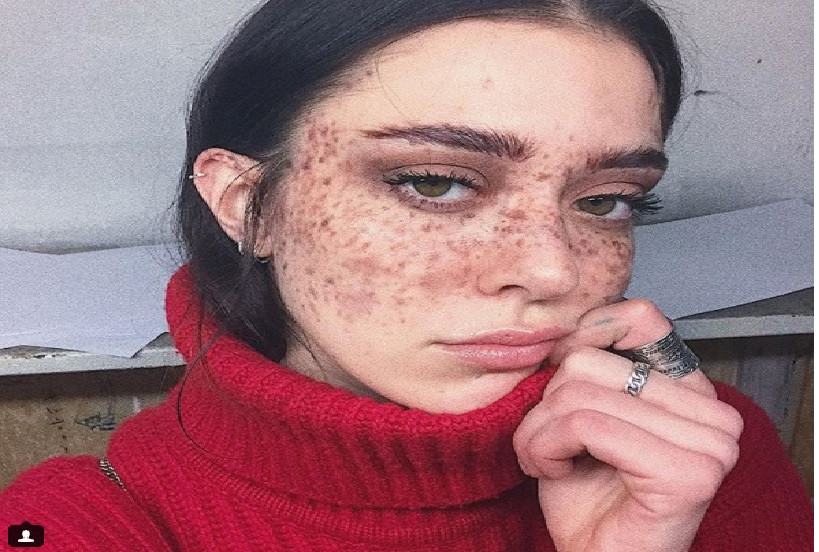 Bạn có thấy tự ti khi ra đường với khuôn mặt này?