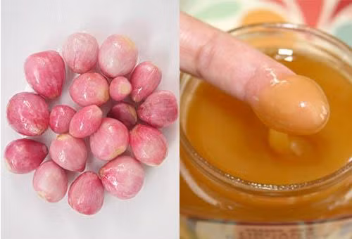 2. Cách trị sẹo thâm lâu năm bằng hành tím: Nguyên liệu cẩn chuẩn bị: 3 củ hành tím, 3 muỗng cafe mật ong nguyên chất