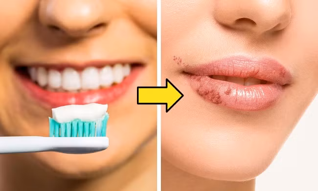 2. Dùng bàn chải đánh răng cho môi: Đây là mẹo tẩy da chết môi nhưng có thể làm cho da môi bị tổn thương và vi khuẩn có thể xâm nhập.