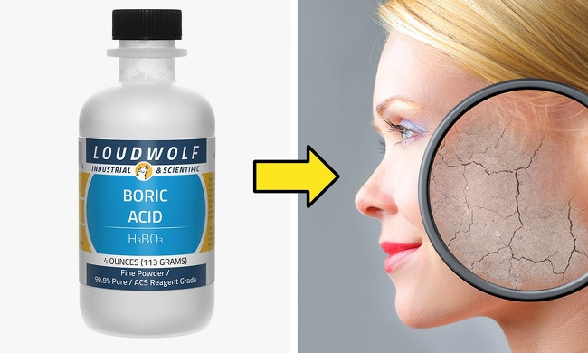 10. Sử dụng axit boric để làm sạch da: Đây là một loại chất tẩy rửa và có thể gây bỏng, kích ứng da.