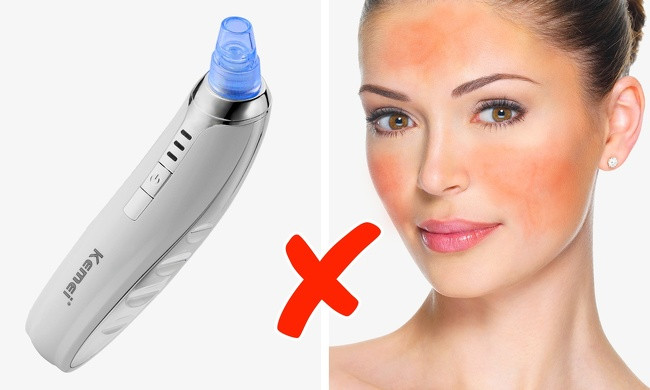 6. Máy hút mụn trứng cá: Có rất nhiều sản phẩm được bán trên mạng nhưng nó không hoàn hảo như bạn nghĩ nếu da bạn nhạy cảm.