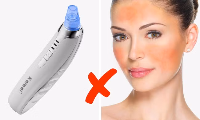 6. Máy hút mụn trứng cá: Có rất nhiều sản phẩm được bán trên mạng nhưng nó không hoàn hảo như bạn nghĩ nếu da bạn nhạy cảm.