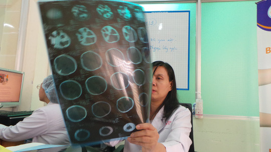  Mẹ lau sàn làm con chấn thương sọ não: Tháng 1/2017, chị con chị Lê Thị Hoa, (trú tại quận 1, TPHCM) đưa con nhập viện Nhi Đồng 2 (TP HCM) trong tình trạng tím tái, gồng cứng người. Nguyên nhân do mẹ bất cẩn lau sàn nhà khiến con bị ngã đập đầu mạnh vào sàn nhà. Ảnh minh hoạ.