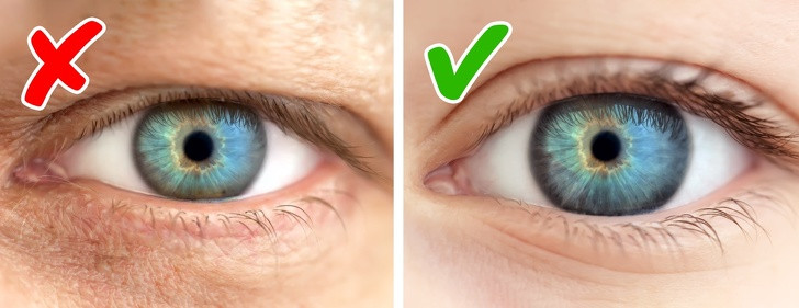 2. Nếp nhăn ở mắt: Khu vực da này rất mỏng bước sang tuổi 40 thường xuất hiện nhiều hơn. Đây cũng chính là bộ phận cơ thể có dấu hiệu tuổi già rõ nhất, bạn nên biết để có cách phòng ngừa.