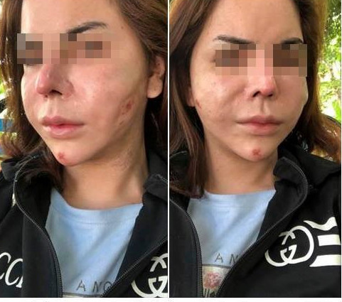 Gương mặt của Linda trước khi bị biến dạng.