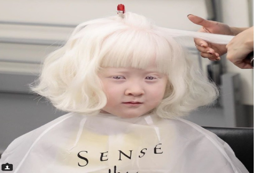 Cô bé này là người Albino. Một trong số người chiếm tỷ lệ rất ít trên thế giới.