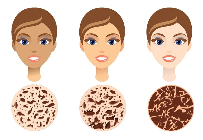 Dieu gi xay ra khi co the thieu anh nang mat troi?