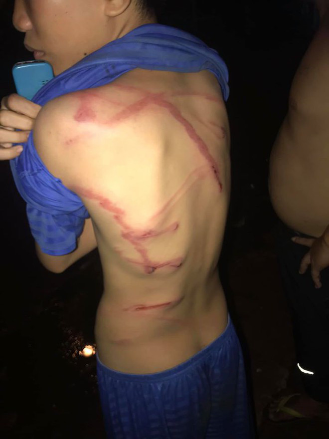 Cha dùng dây điện đánh con 12 tuổi vì lấy trộm thẻ điện thoại nạp game - Hình 2 Cha dung day dien danh con 12 tuoi vi lay trom the dien thoai nap game-Hinh-2