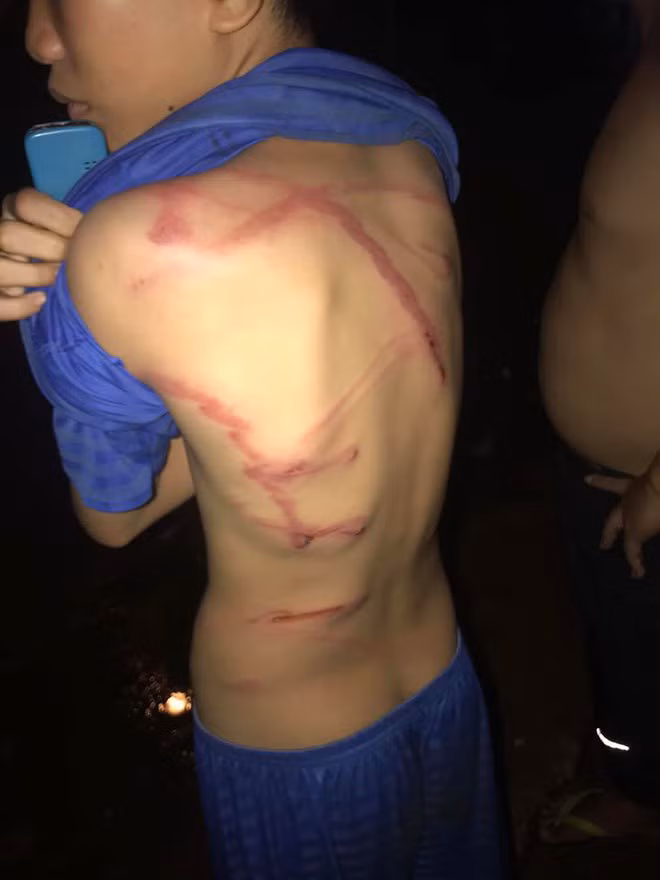 Cha dùng dây điện đánh con 12 tuổi vì lấy trộm thẻ điện thoại nạp game - Hình 2 Cha dung day dien danh con 12 tuoi vi lay trom the dien thoai nap game-Hinh-2