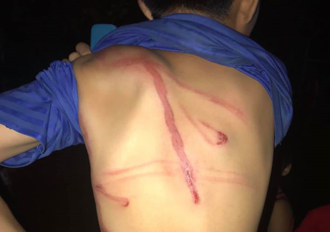 Cha dùng dây điện đánh con 12 tuổi vì lấy trộm thẻ điện thoại nạp game Cha dung day dien danh con 12 tuoi vi lay trom the dien thoai nap game