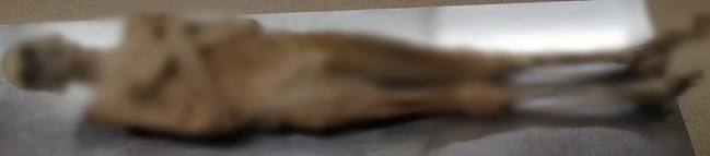 Các chuyên gia đã phân tích xác ướp một tu sĩ người Áo sống vào thế kỷ 18 qua đó có khám phá bất ngờ về cách ướp xác. Theo họ, tu sĩ qua đời vì bệnh lao và được bảo quản bằng cách khác thường: nhét dăm gỗ, cành cây và vải vào bụng qua hậu môn. Ảnh: Andreas Nerlich.