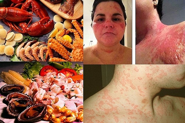 Cach phong tranh ngo doc hai san khong phai ai cung biet-Hinh-2