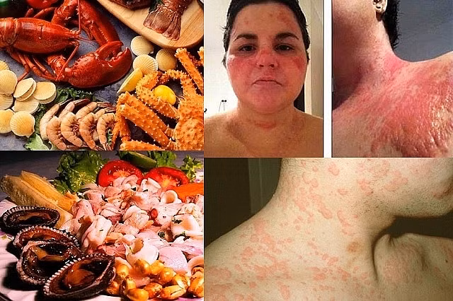 Cach phong tranh ngo doc hai san khong phai ai cung biet-Hinh-2