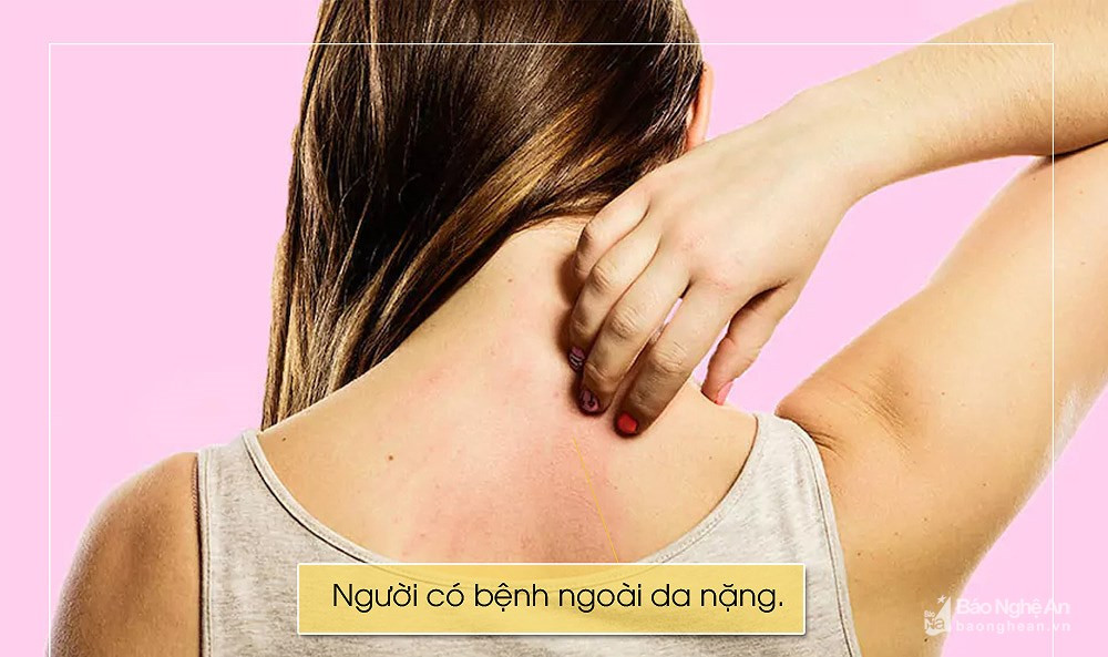 Nhung nguoi khong nen xong hoi giai cam ngay lanh-Hinh-4