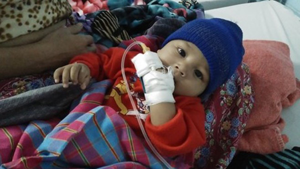 Cô bé 5 tháng tuổi đã phải nhập viện để điều trị sỏi thận