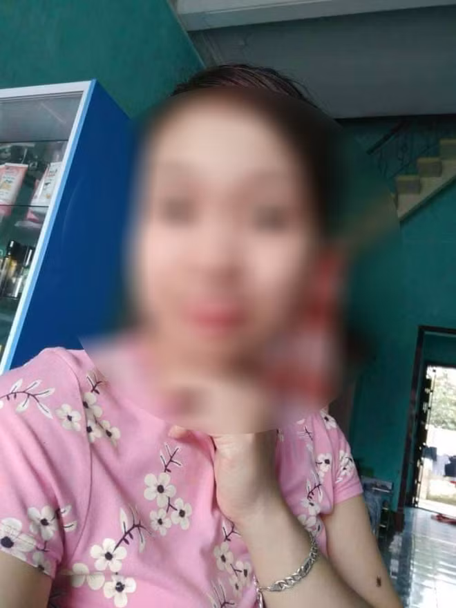 Sau khi thu nhận thông tin từ các nơi báo về, lực lượng chức năng phát hiện một vụ mất tích trước đó 2 ngày. Người mất tích là chị Nguyễn Thị Hằng (29 tuổi, trú tại thôn Khôi Vỹ Thượng, xã Quang Phục, huyện Tiên Lãng). Gia đình chị Hằng cho biết, chị này đã đi khỏi nhà từ ngày 7/11 và không thấy trở về.