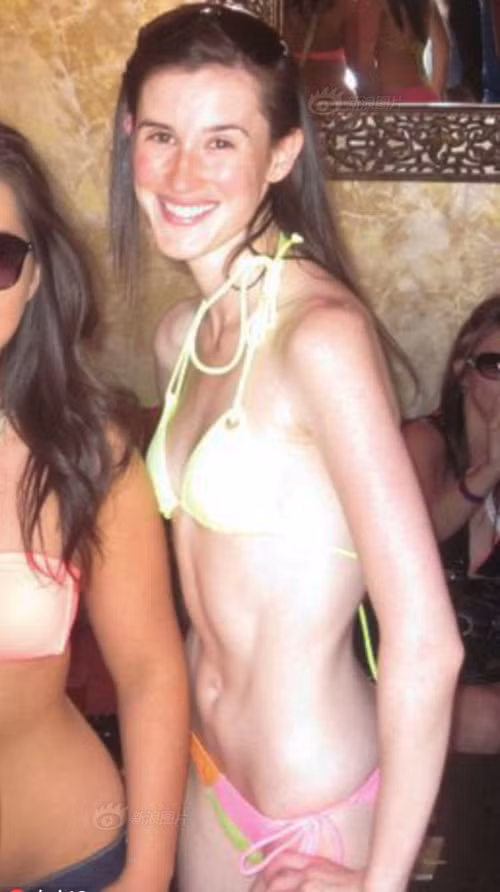 Hai năm sau sự cố kinh hoàng, căn bệnh rối loạn tâm lý và hoảng sợ, lo âu của Sarah tồi tệ hơn. Chỉ trong vòng chưa tới nửa năm, cô gái trẻ lúc này đã 21 tuổi giảm liên tục 15kg, cân nặng chỉ khoảng trên dưới 41kg. (Nguồn Sina)