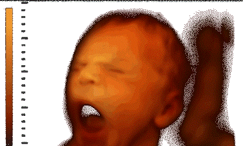 Điều kỳ diệu thai nhi biết làm khi ở trong bụng mẹ Dieu ky dieu thai nhi biet lam khi o trong bung me