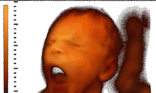 Điều kỳ diệu thai nhi biết làm khi ở trong bụng mẹ Dieu ky dieu thai nhi biet lam khi o trong bung me